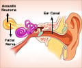 Auditory Tumor - Causes Symptoms Diagnosis Treatment Prognosis Complications Auditory Tumor - Causes Symptoms Diagnosis Treatment Prognosis Complications