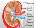 Acute Renal (Kidney) Failure- Causes, Symptoms, Diagnosis, Treatment and Complications