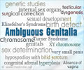 Ambiguous Genitalia - Symptoms, Diagnosis, Treatment Ambiguous Genitalia - Symptoms, Diagnosis, Treatment