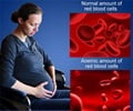 Anemia in Pregnancy - Causes Prevention Symptoms Diagnosis Treatment