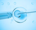 Assisted Reproductive Technologies - Types, Preparation, Procedure & Risk Factors