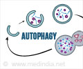 Autophagy: Self-Repair Mechanism at Cellular Level Autophagy: Self-Repair Mechanism at Cellular Level