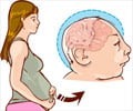 Birth Defects - Types, Causes, Diagnosis, Prevention, Treatment