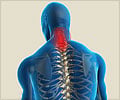 Cervical Spondylosis - Causes - Symptoms - Diagnosis - Treatment - FAQs