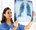 Chest Radiography | Chest X-ray Radiography Chest Radiography | Chest X-ray Radiography