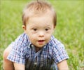Christianson Syndrome - About  Causes  Symptoms  Diagnosis  Treatment