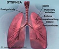 Dyspnea / Shortness of Breath