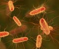 E. coli Infection | Escherichia coli Infection - Causes, Diagnosis, Symptoms, Treatment, Risk Factors & Prevention E. coli Infection | Escherichia coli Infection - Causes, Diagnosis, Symptoms, Treatment, Risk Factors & Prevention