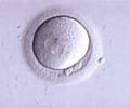 Egg Donation