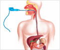 Gastroscopy - Indication, Contraindication, Performance, Complications, FAQs Gastroscopy - Indication, Contraindication, Performance, Complications, FAQs