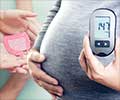 Microbial Link between Gut Health and Gestational Diabetes Mellitus (GDM)