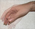 Hand Tremor - Symptom Evaluation