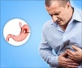 Heartburn - Symptom Evaluation Heartburn - Symptom Evaluation