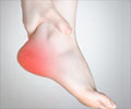 Heel Pain - Symptom Evaluation - Causes, Diagnosis, Treatment, Helth Tips, FAQs