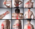 Inflammation - Causes, Symptoms, Diagnosis, Treatment & Prevention