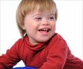 Intellectual disability | Mental Retardation - Causes Symptoms Diagnosis Treatment
