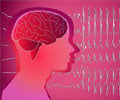 Juvenile Myoclonic Epilepsy - Causes Symptoms Diagnosis Treatment & Prevention