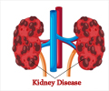 Prevention of Kidney Disease - Causes & Prevention