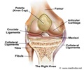 Osteochondritis Dissecans-Causes-Risk Factors-Symptoms-Diagnosis-Treatment-FAQs