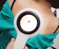 Melanoma - Causes, Symptoms, Diagnosis, Treatment & Prevention