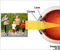 Myopia - Symptoms and Diagnosis - Treatment - FAQs