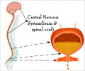 Neurogenic Bladder - Causes, Symptoms, Diagnosis, Treatment