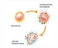 Oxidative Stress | Free Radicals Cell Injury - Causes, Symptoms, Diagnosis and Prevention