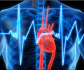 Palpitations Symptom Evaluation - Causes - FAQs