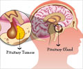 Drugs for Treatment of Pituitary Tumors