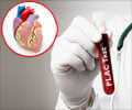PLAC Test for Cardiovascular Disease PLAC Test for Cardiovascular Disease