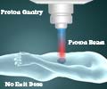 Proton Beam Therapy for Cancer Treatment Proton Beam Therapy for Cancer Treatment