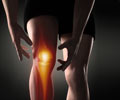 Runner's Knee | Patellofemoral Pain Syndrome - Causes, Symptoms, Diagnosis, Treatment, Prevention