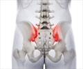 Sacroiliac Joint Dysfunction Sacroiliac Joint Dysfunction