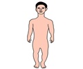 Birth Defects - Genetic - Achondroplasia 