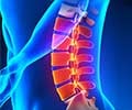 Spinal muscle Atrophy (SMA): Can Muscle Atrophy from Nerve Damage be Reversed? Spinal muscle Atrophy (SMA): Can Muscle Atrophy from Nerve Damage be Reversed?