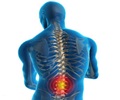 About Spondylosis About Spondylosis