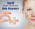 Ten Most Common Skin Disorders