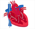 Truncus Arteriosus - Types, Risk Factors, Clinical Features, Management & Prevention Truncus Arteriosus - Types, Risk Factors, Clinical Features, Management & Prevention