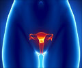 Vulvar Cancer - Symptoms - Diagnosis - Treatment - FAQs
