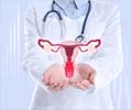 Vulvodynia: Causes, Symptoms, Diagnosis, Treatment & Complications