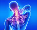 Whiplash and Conditions that Mimic Whiplash
