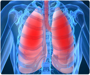 Chronic Obstructive Pulmonary Disease