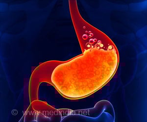 Acidity - Causes, Symptoms, Diagnosis, Treatment & Complications