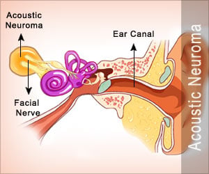 Auditory Tumor  - Causes Symptoms Diagnosis Treatment Prognosis Complications