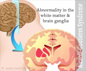 Aicardi-Goutieres Syndrome - Causes, Symptoms, Diagnosis, Treatment