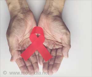 AIDS/HIV - Kaposi''s sarcoma