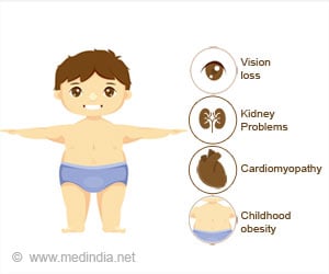 Alström Syndrome | Alström–Hallgren Syndrome - Causes, Symptoms, Diagnosis, Treatment & Prognosis