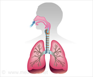 Aspergillosis - Types, Causes, Symptoms, Diagnosis, Treatment and Prevention