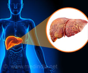 Autoimmune Hepatitis - Causes, Types, Symptoms, Complications, Diagnosis & Treatment