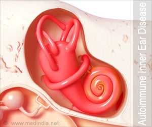 Autoimmune Inner Ear Disease Causes, Symptoms, Diagnosis and Treatment